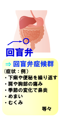 回盲弁の位置を示すイラスト