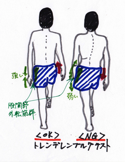 トレンデレンブルグテストをイメージしたイラスト