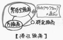 慢性頭痛におけるカイロプラクティックの適応範囲を示すイメージ図