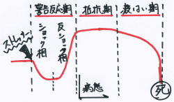 ストレスに対する身体の反応の曲線をイメージしたイラスト