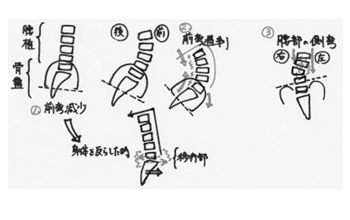 腰椎の不良姿勢パターンのイラスト