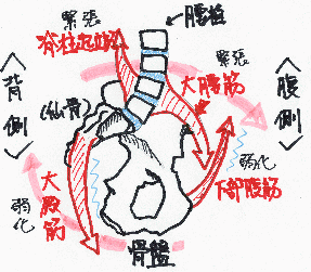 下位交差症候群における骨盤前後の筋パターンを示したイラスト